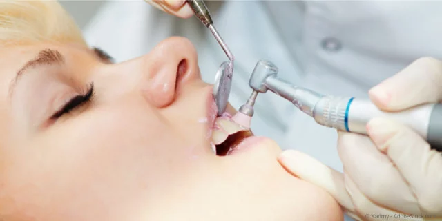 Professionelle Zahnreinigung (PZR)